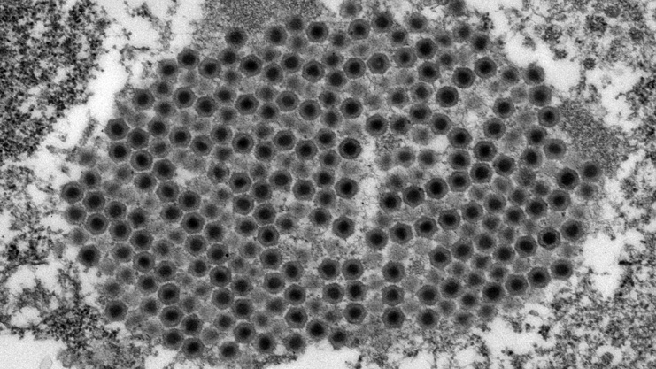 Iridovirus